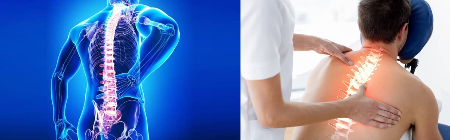 Лечение остеохондроза с помощью остеопатии